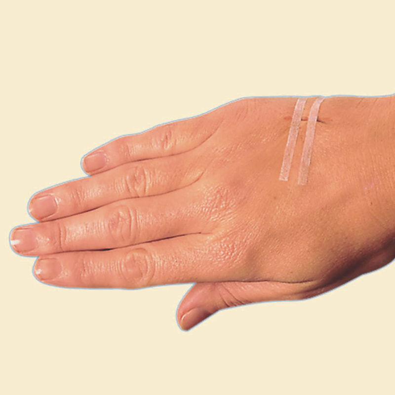 Proužek pro uzavření kůže